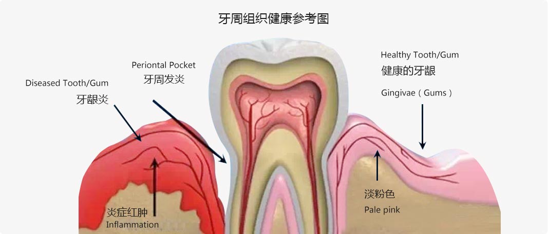 牙周組織健康參考圖